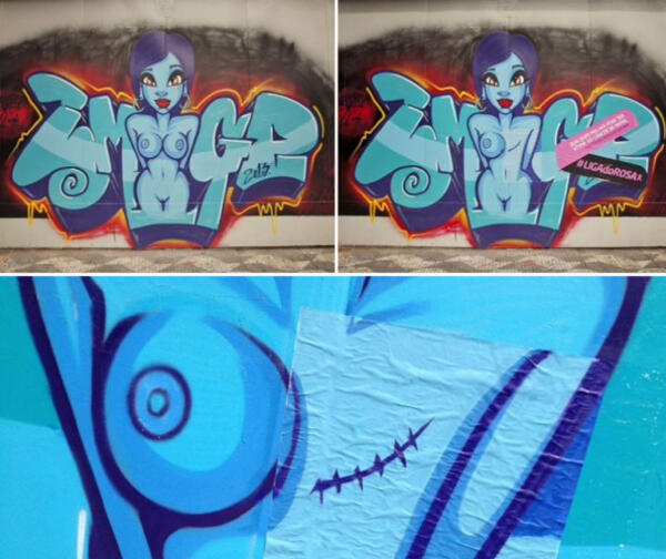 Графити, оперирани от рак на гърдата