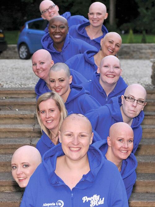12 смели жени без коса заедно срещу клишетата