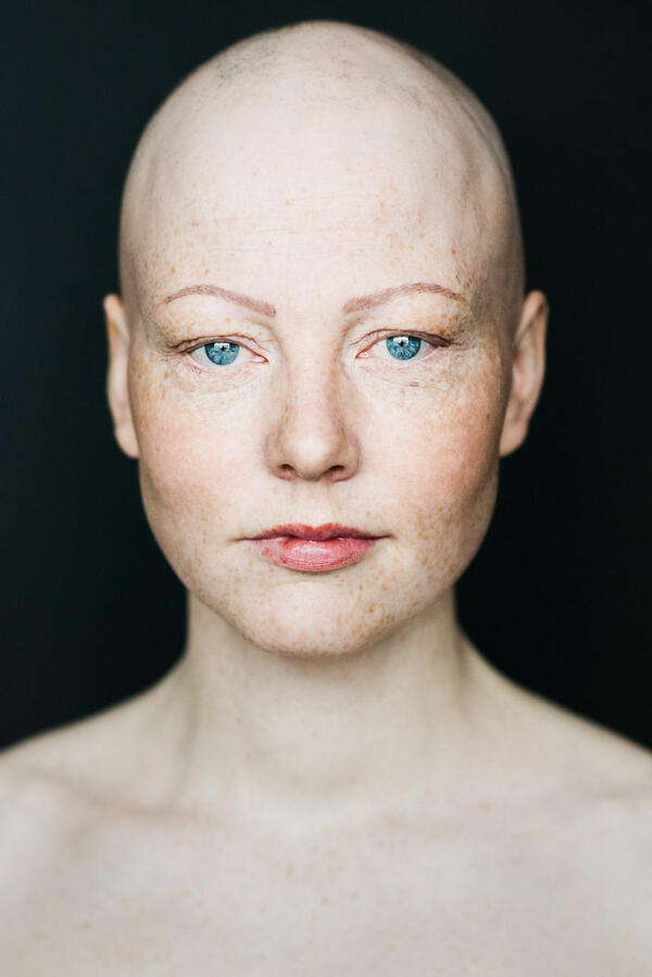 Проект "Сила": Жената е красива дори без коса!