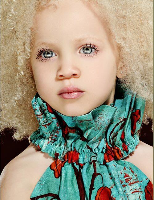 Момиченце афроамериканка-албинос е новата звезда в модния свят