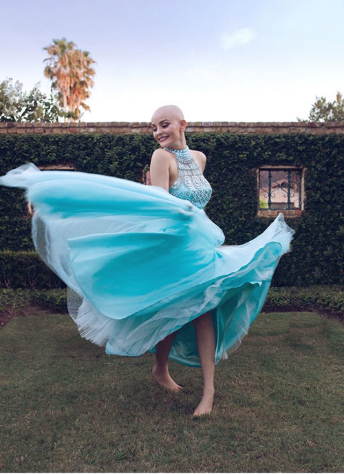 Вдъхновяваща фотосесия на едно болно момиче от рак без перуката й