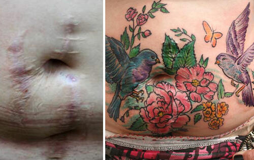Тези красиви татуировки трансформират белезите от домашно насилие