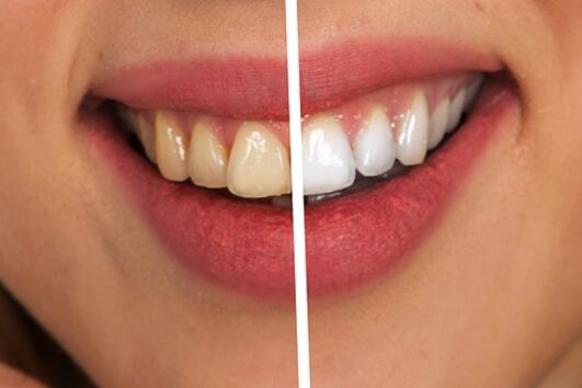 8 грешки, които допускаме в грижата за зъбите 
