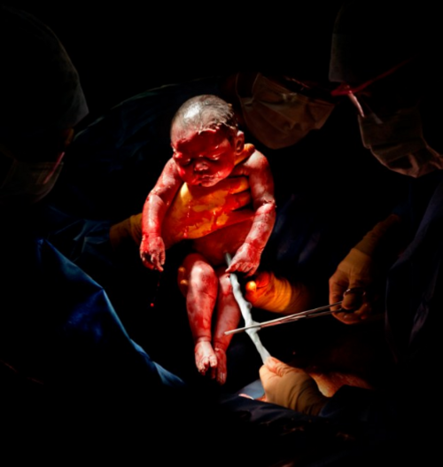 Как изглеждат бебетата няколко секунди, след като се родят?