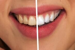 Зъбите ви както и всяка друга част от тялото ви