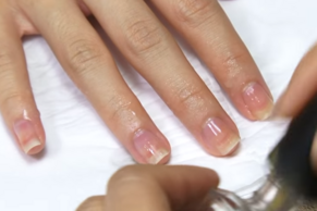 Правилното премахване на кожичките на ноктите е изключително важно за