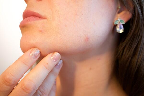 Как да разберем дали кожата ни е суха или дехидратирана според дерматолозите?