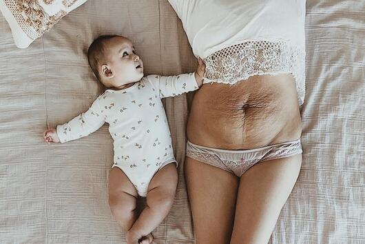 Майка на 5 деца публикува снимка на корема си, за да покаже, че женското тяло не винаги е красиво 