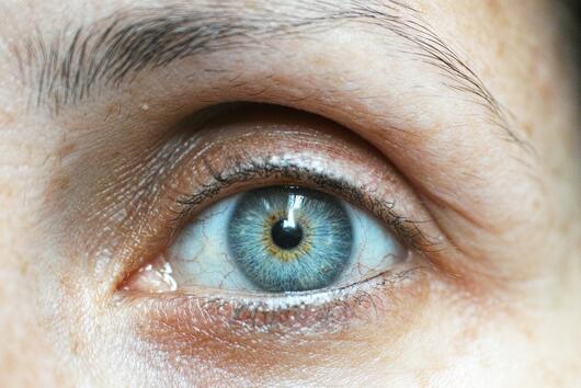 Ечемик на окото- колко дълго продължава и как можете да се справите с него?