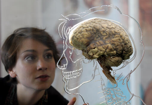 Женският мозък е по-устойчив на заболявания
