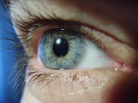Странно, но факт: човешката красота се определя от бялото на очите