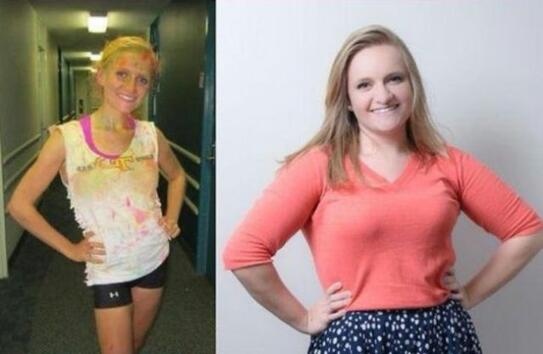 Преди и след: В капана на анорексията