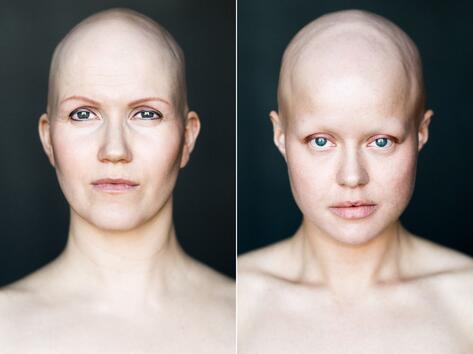 Проект "Сила": Жената е красива дори без коса!
