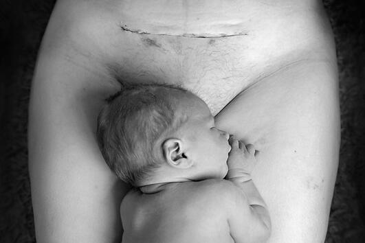 Снимка на бебе, което лежи до белега на майка си от цезарово сечение