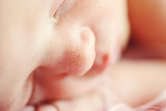 6 начина за лечение на бебешка екзема 