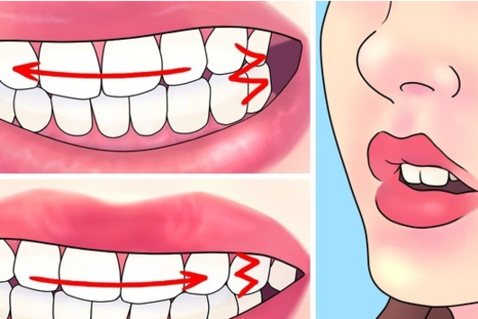 Как да спрете да скърцате със зъби нощем? 