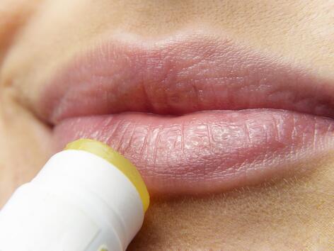 8 начина да се справите с херпеса на устните изключително бързо