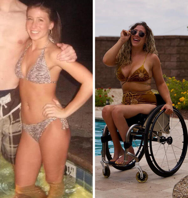 Сърцераздирателната история на едно момиче в инвалидна количка 