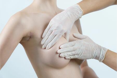 Всичко, което трябва да знаете преди да си поставите гръдни импланти