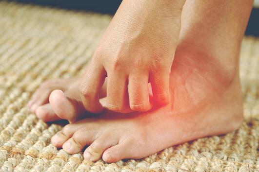 Как да предпазим краката си от появата на гъбички?