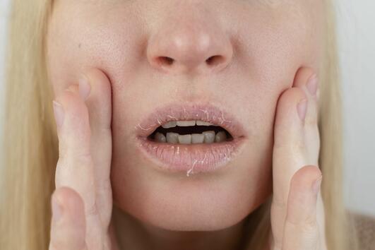 8 причини, поради които устните ви са сухи