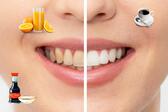 9 храни, които водят до пожълтяване на зъбите
