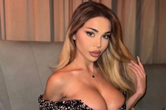 Шермин проговори за корекциите по лицето си