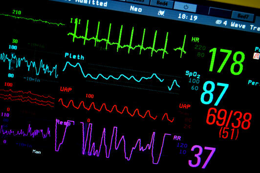 Компютърната томография намалява риска от сърдечно-съдови заболявания
